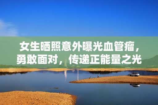 女生晒照意外曝光血管瘤，勇敢面对，传递正能量之光